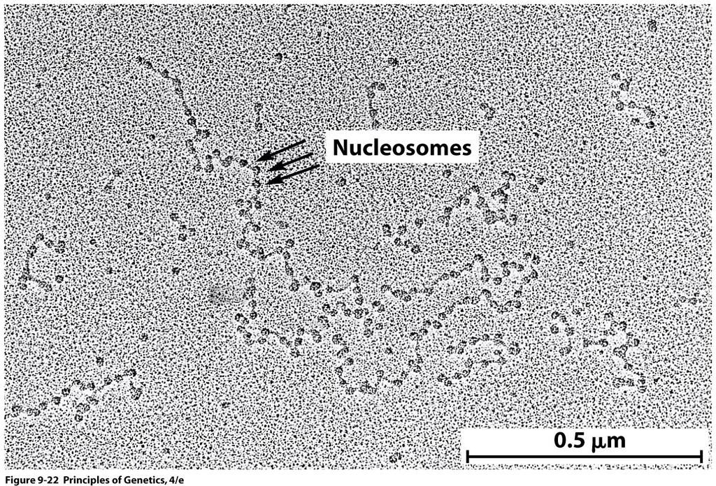 Electron micrograph of rat liver chromatin