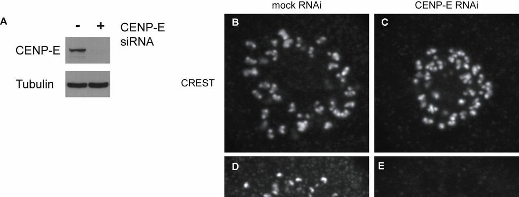 Figure S5. Analysis of CENP-E depletion by RNAi.