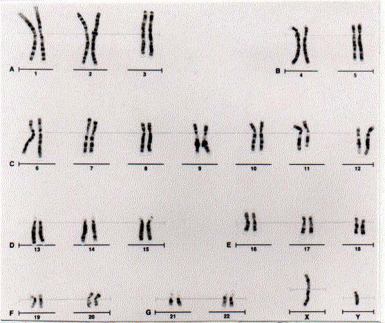 The human karyotype short arm