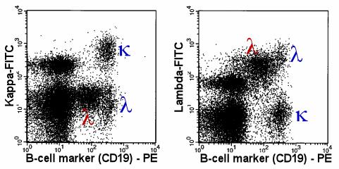 Assuming the second plot shows the same cells, draw the corresponding gates for the different populations in the second plot. Are the malignant cells kappa- or lambda- positive? 7.