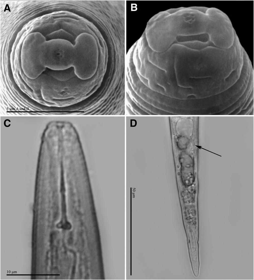 180 Journal of Nematology, Volume 41, No. 3, September 2009 FIG. 6. Second-stage juveniles of Meloidogyne polycephannulata n. sp. A, B) Scanning electron micrographs of head, face and lateral views.
