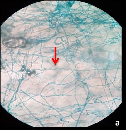 Tow-way ANOVA has demonstrated pathogens hyphae and degradation of interaction effect of antagonistic Trichoderma pathogens mycelium. Trichoderma afroharzianum and pathogens.