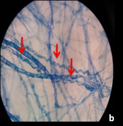 Phytophthora capsici observed in figures commercial Trichoderma. 2 (c) and (d). T8A4; T.