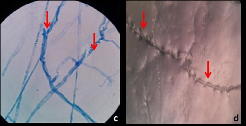 investigated to figures 2 (b), (c) and (d) and produce high detect mycoparasitic signs of Trichoderma number of coils around Rhizoctonia solani (see species such as mycoparasitic coils around figure