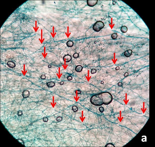 distinguished high density of coils of T. afroharzianum Trichoderma hyphae penetration inside T8A4 hyphae around Rhizoctonia pathogenic mycelium.