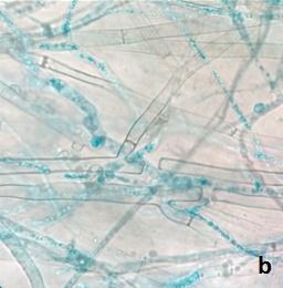 Presence of coils, degraded only in the presence of T8A4 their high density and consistent attachment mycelium as observed in figures 3a and 3b.