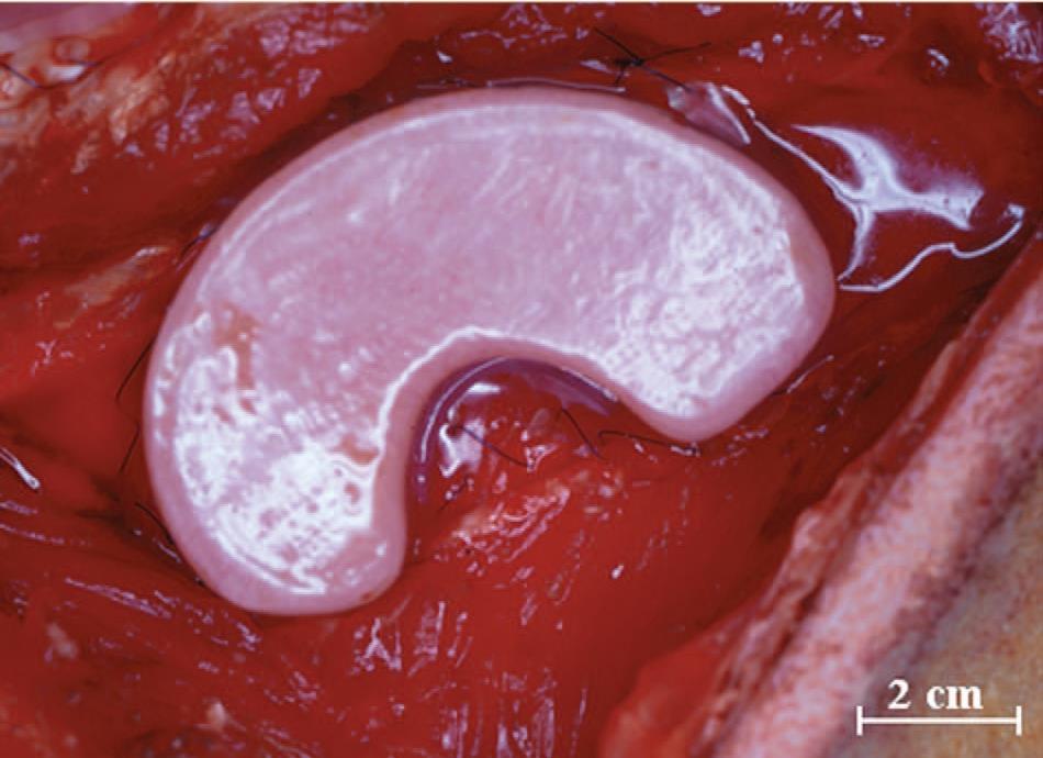 in vivo bioreactor growth of vascularized bone within the body by implantation of a molded chamber against the periosteum