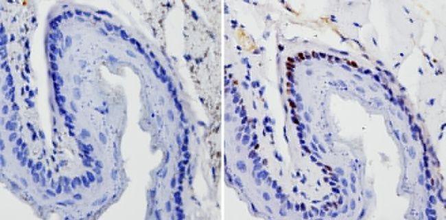 SOX2 Antibody (MA1-014) in IHC (P) Immunohistochemistry analysis of SOX2 showing staining in the nucleus of paraffin-treated mouse esophagus tissue (right) compared with a negative control without