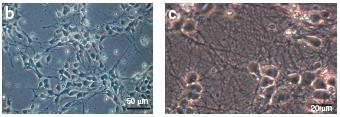 Add retinoic acid to enrich neural progenitors 10 days Monolayer culture in