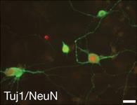 Therapeutic Neuron Replacement in Cells Differentiated fibroblasts have been directly converted to neurons without going through a