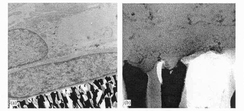 increased in vitro new bone synthesis on nano-porous alumina.