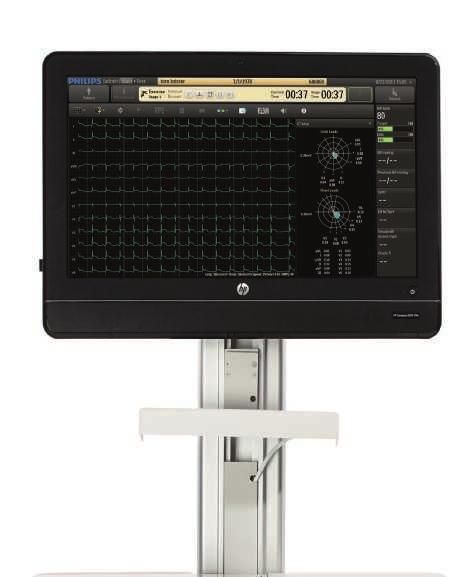 Advanced analytical methods The ST80i features tools to help clinicians analyze stress ECG information.