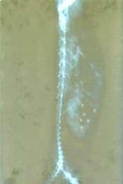 1 (B):   Microbeads (x-ray