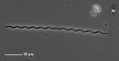 Very long spiralshaped bacteria are known as