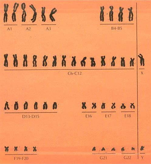 identification of the chromosomes.