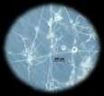 philippii mycelia Biocontrol isolates (Cerrena &