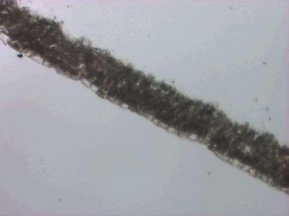 Microdissection (LCM) 150 microns Spores»