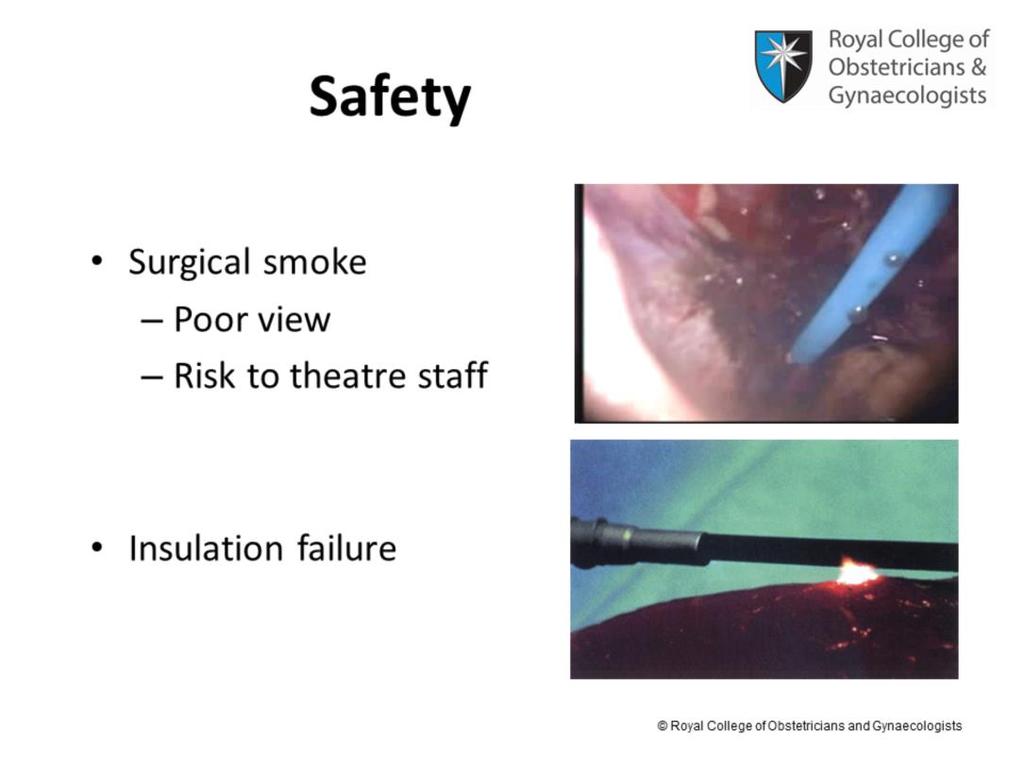 The other hazards associated with endoscopic electrosurgery use are production of surgical smoke, which creates poor view and because of the toxic gases, it can be a risk to theatre staff.
