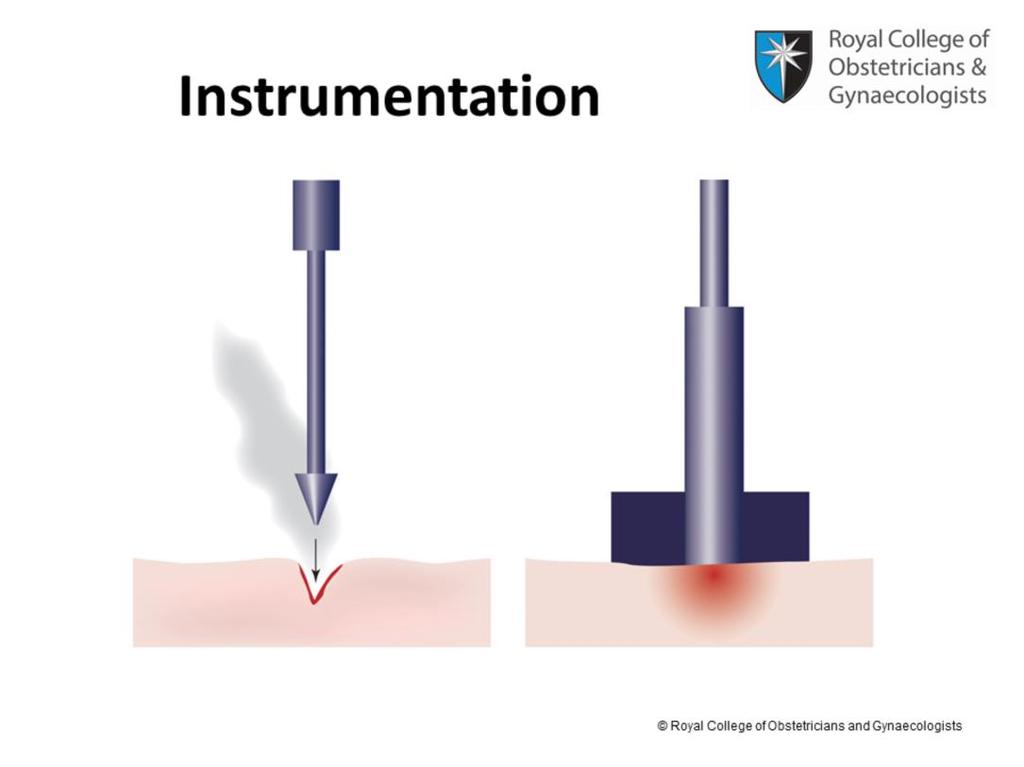 This diagram shows the effect of electricity depending on surgical instrument electrode size.