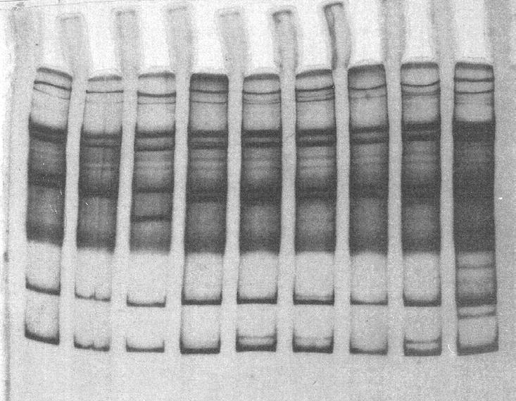 FAECAL ESBL-PRODUCING COLIFORMS 1 2 3 4 5 6 7 8 9 FIG. 1: PCR-SSCP of amplified SHV gene products from SHV controls and SHV genes isolated from ESBLproducing E. coli.