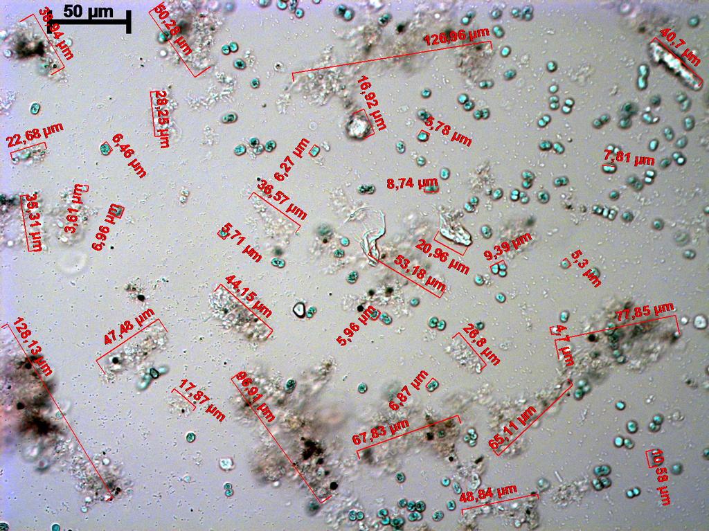10 Photos 400x Resultados - Microcys:s Cells/ml 1E+6 1E+4 1E+2 Cryptomonadas uni. (4 um) Microcys:s uni. (6um) M. duplicando (9um) detritos 1E+0 Biovolume Cryptomonadas diameter = 4.