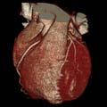 Ultrasound CT MR Cardiac &
