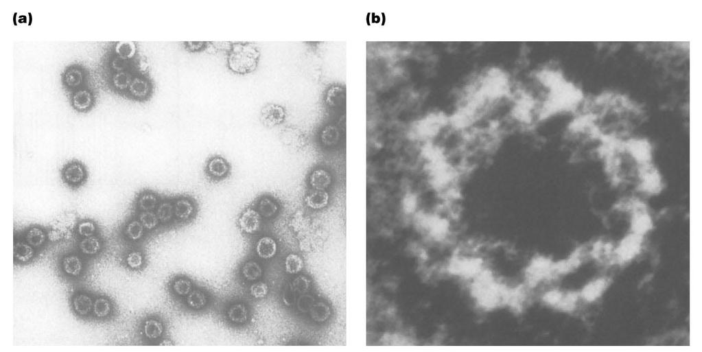 Electron microscopic images of virus-like particles