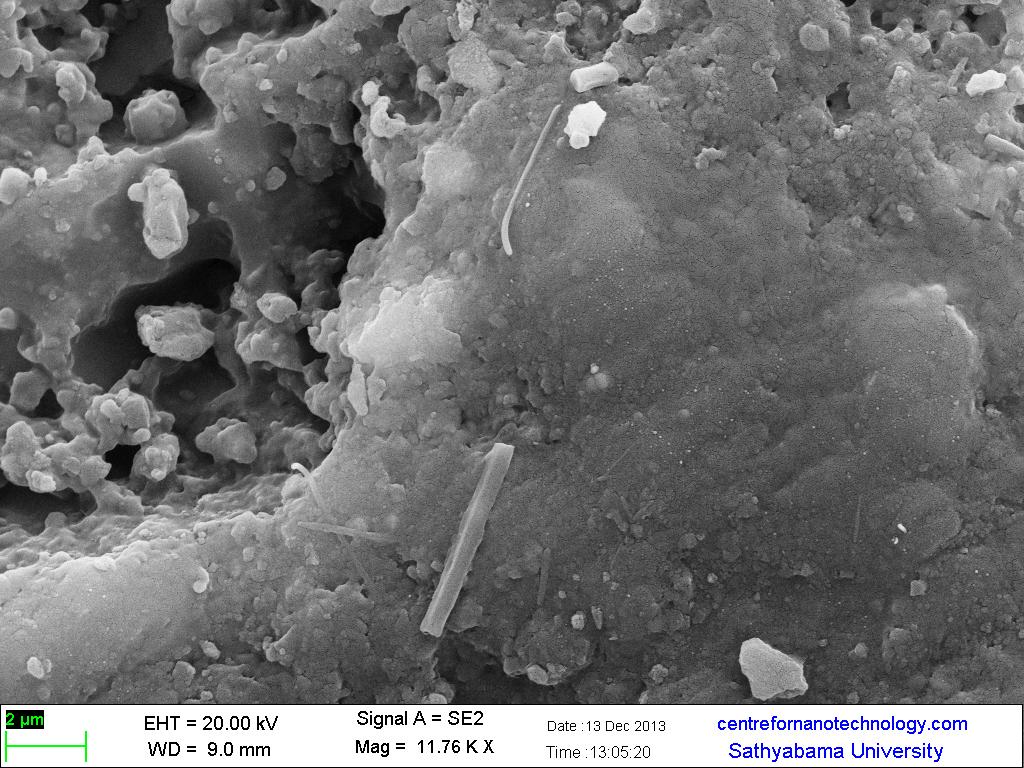 The images obtained by the SEM imaging