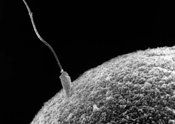 6 The photograph shows a sperm and an egg before fertilisation.