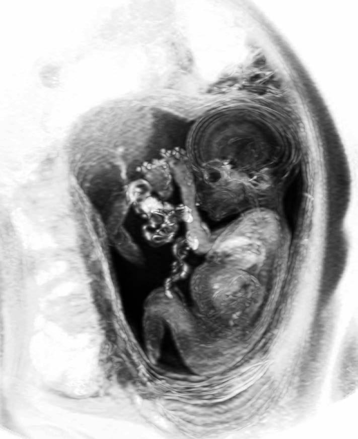 placenta space A Ghislain & Marie David De Lossy /