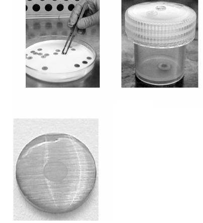 Figure 1 (left): Ten µl of the test organism inoculum being removed