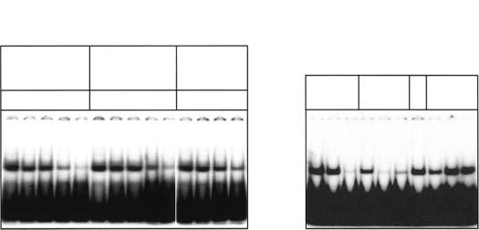 coli extract without SpaR; lane 13 (13 ) 20 ng SpaR analysed by EMSAs or Western blotting using SpaR antiserum. B and C. spas + spab promoter. Lanes 1 4: 2, 5, 10 and 20 ng SpaR.
