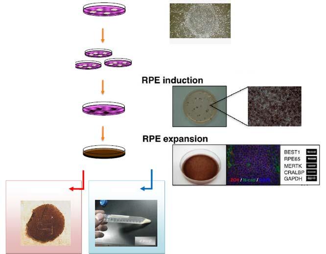 Manufacture of ips cell-derived retinal pigment epithelial cells ips cells Induction of RPE differentiation Expansion of RPE