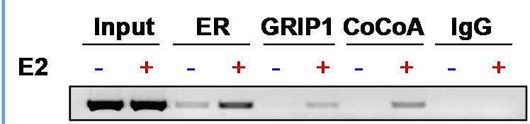 Standard ChIP procedure- continued Anti- antibody + protein A/G-beads E ps2 gene Chromatin IP Immunoprecipitate protein-dna complexes with specific antibodies.