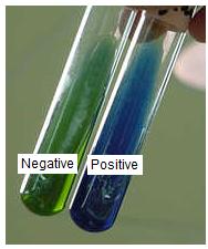Activity 5.1.5: Student Resource Sheet Biochemical tests are the most definitive way to identify bacterial species.