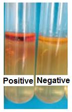 media that are used for this test: Sulfide-Indole-Motility (SIM) medium and Tryptone broth medium.