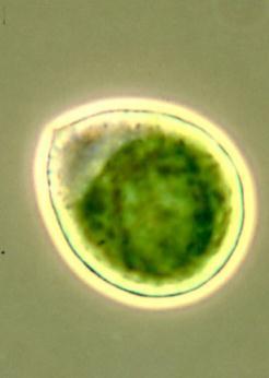 Why microalgae?