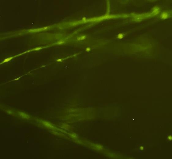 It is worth noting that the entrapment of the cells inside the fibre shell was not as clear by standard microscopy techniques. Nevertheless, fluorescence emission as result of E.