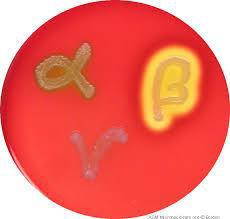 Blood Agar: Enriched medium (provide extra nutrient for bacteria).