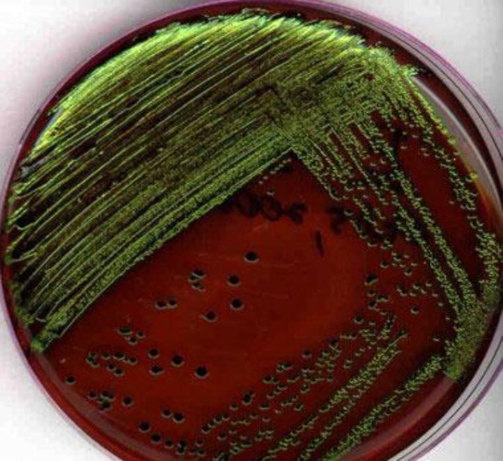E. coli on EMB