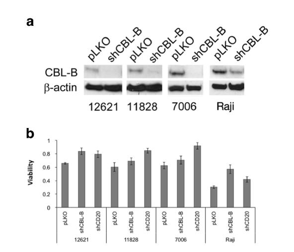expression Immunofluorescence assay showing CD20
