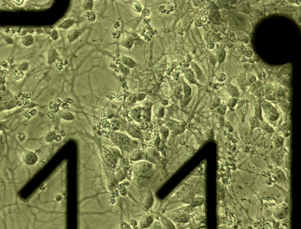 200µm Figure 3: ArunA mmngfp+ Mouse Motor Neurons Placement ArunA mmngfp+ Mouse Motor Neurons (60,000) at day 6 in vitro in a 12-well MEA, 4x magnification.