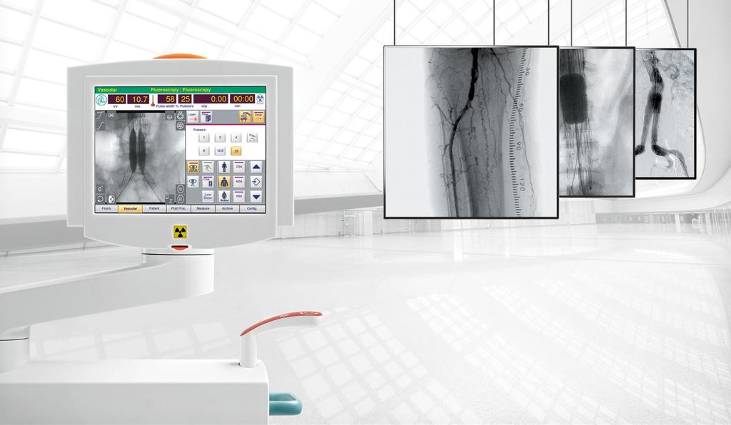 18 19 Ziehm Vision RFD Hybrid Edition The right organ program with just one Click Every application presents specific challenges for imaging.