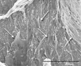 Electrospinning to produce 3D scaffolds Method Collector: bath filled with methanol Porogen: NaCl particles with a diameter of 300-500 μm Salt leaching Results Nano-sized