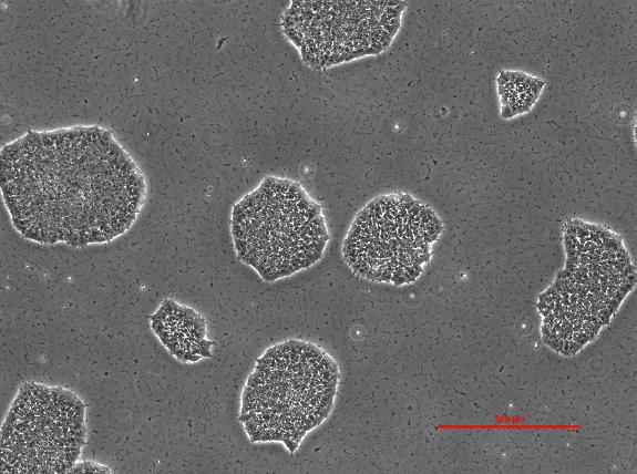Cells maintain a spikey morphology due to RI treatment.