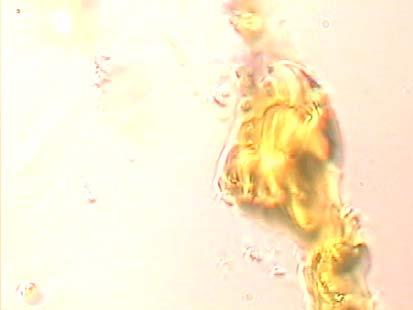 Algae Cells