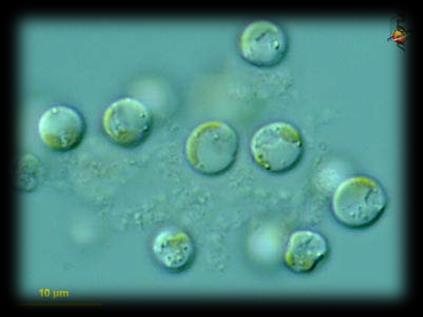 Planktonic Algae Constantly present in ponds, fortunately in moderate