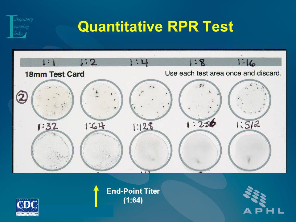 Interpretation of RPR Test 33 Non-reactive (NR) smooth suspension, no clumping