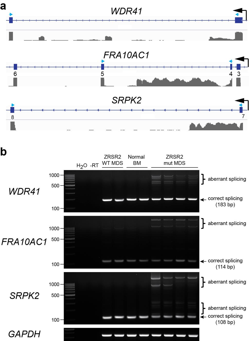 Supplementary Figure 12 Supplementary Fig. 12 RT-PCR analysis verifies presence of aberrant transcripts of WDR41, FRA10AC1 and SRPK2 in ZRSR2 mutant MDS.
