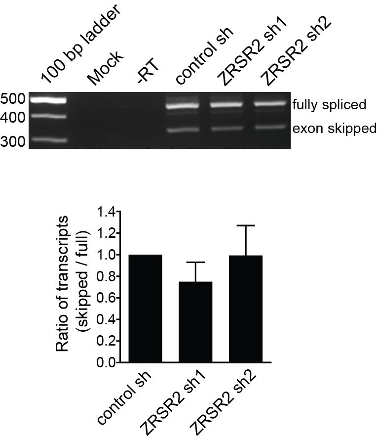 Supplementary Figure 2 Supplementary Fig. 2 Knockdown of ZRSR2 does not affect splicing of GH1 minigene introns.